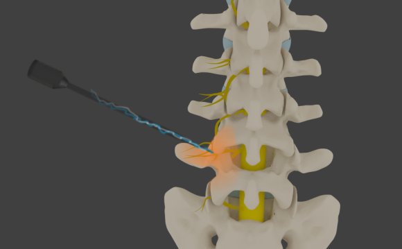 Pain Management Doctors in Houston Texas